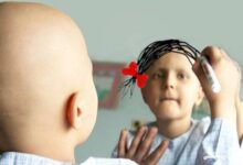 بررسی وضعیت سرطان کودکان در ایران - خبرگزاری مهر ایران و جهان