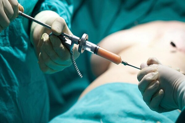 82 درصد تهرانی های بالای 30 سال دارای اضافه وزن یا چاق هستند