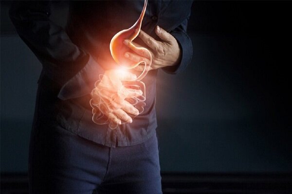 درمان رفلاکس در ماه رمضان؛ افطاری سبک، معده سالم - خبرگزاری مهر ایران و جهان