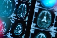 هشدار به بیماران صرعی و آسمی در خصوص قطع دارو در ایام روزه داری - خبرگزاری مهر ایران و جهان