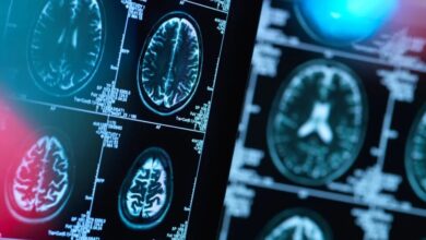 هشدار به بیماران صرعی و آسمی در خصوص قطع دارو در ایام روزه داری - خبرگزاری مهر ایران و جهان