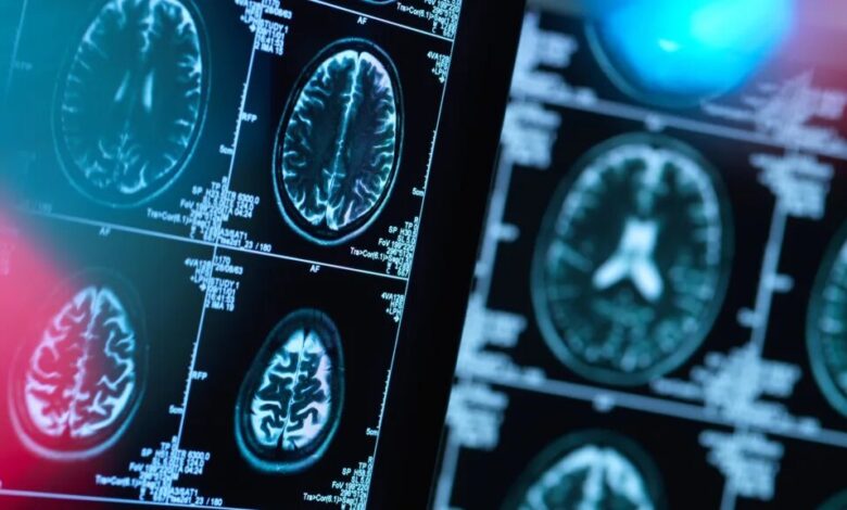 هشدار به بیماران صرعی و آسمی در خصوص قطع دارو در ایام روزه داری - خبرگزاری مهر ایران و جهان