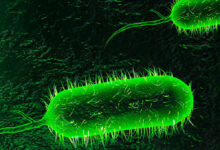 آخرین وضعیت بیماری وبا در ایران، منطقه و جهان اعلام شد - خبرگزاری مهر ایران و جهان