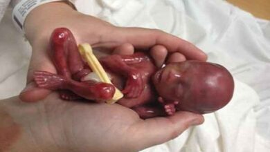 سقط جنین؛ از «صنعت پول سیاه» تا عوارض جسمی و روحی جبران ناپذیر - خبرگزاری مهر ایران و جهان