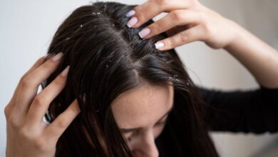 علت شوره سر و راهکارهای گیاهی برای درمان آن