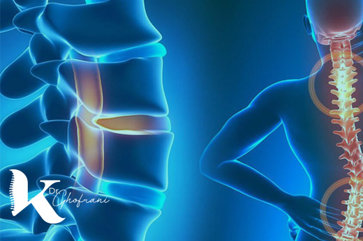 التهاب مفاصل فاست کمر و راه های درمان آن