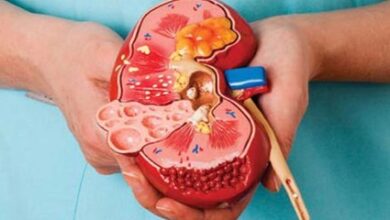 قبل از اینکه سنگ کلیه غافلگیرتان کند، ببینید جزو افراد پرخطر هستید یا نه!