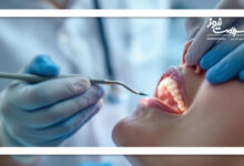 اهمیت سلامت دندان‌ها قبل از بارداری