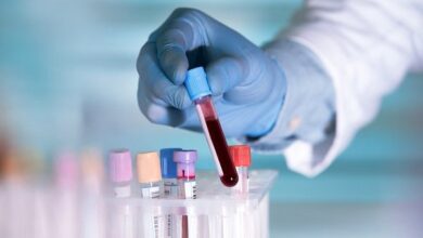 تاثیر آزمایش خون مبتنی بر DNA در درمان سرطان گلو - خبرگزاری مهر ایران و جهان