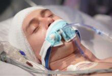 ضربه به سر ممکن است سلامت روده را مختل کند - خبرگزاری مهر ایران و جهان