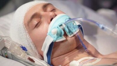 ضربه به سر ممکن است سلامت روده را مختل کند - خبرگزاری مهر ایران و جهان