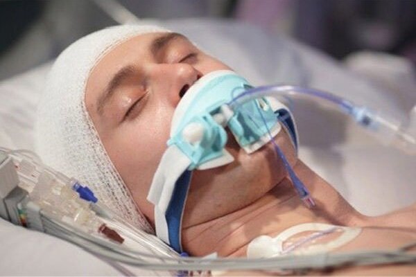ضربه به سر ممکن است سلامت روده را مختل کند - خبرگزاری مهر ایران و جهان