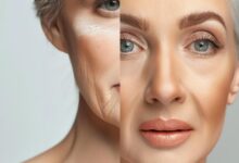 مزوژل‌های ایرانی با تکیه بر امنیت و کیفیت، رقیب جدی برندهای خارجی هستند