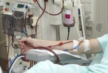 پرداخت بیش از 1.4 همات مطالبات مرکز دیالیز