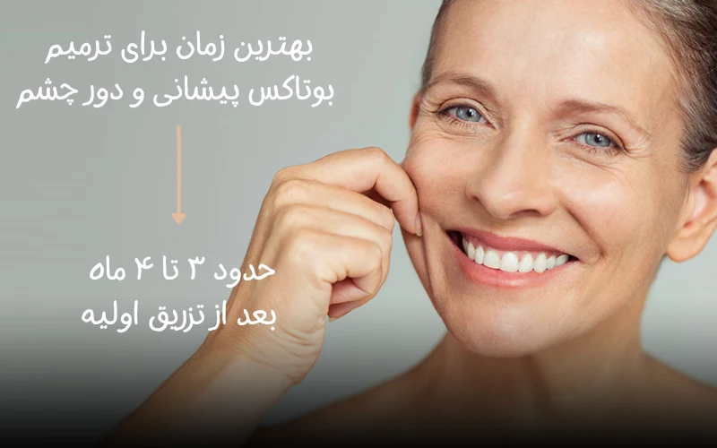 بهترین زمان برای ترمیم بوتاکس پیشانی و دور چشم چه زمانی است؟