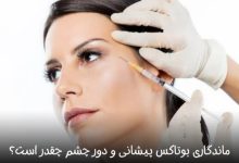 ماندگاری بوتاکس پیشانی و دور چشم چقدر است؟