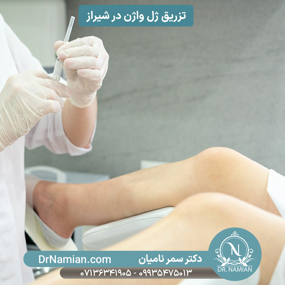 فیلر بیکینی دکتر سمر نامیان