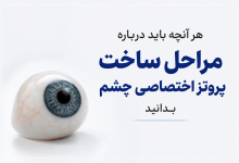 هر آنچه باید درباره مراحل ساخت پروتز اختصاصی چشم بدانید