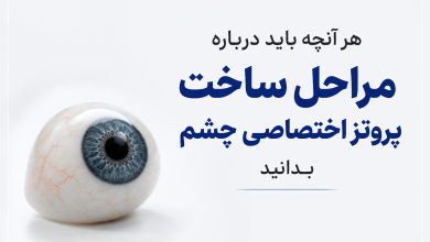 هر آنچه باید درباره مراحل ساخت پروتز اختصاصی چشم بدانید