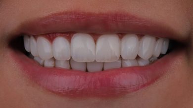 لمینت یا کامپوزیت؟ راهنمای جامع انتخاب بهترین روش اصلاح طرح لبخند