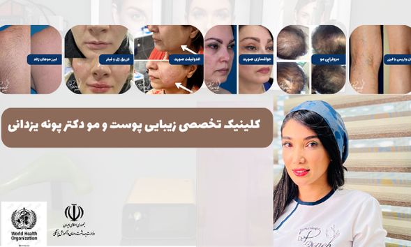 بهترین لیفت صورت بدون جراحی با لیزر در تهران + آدرس