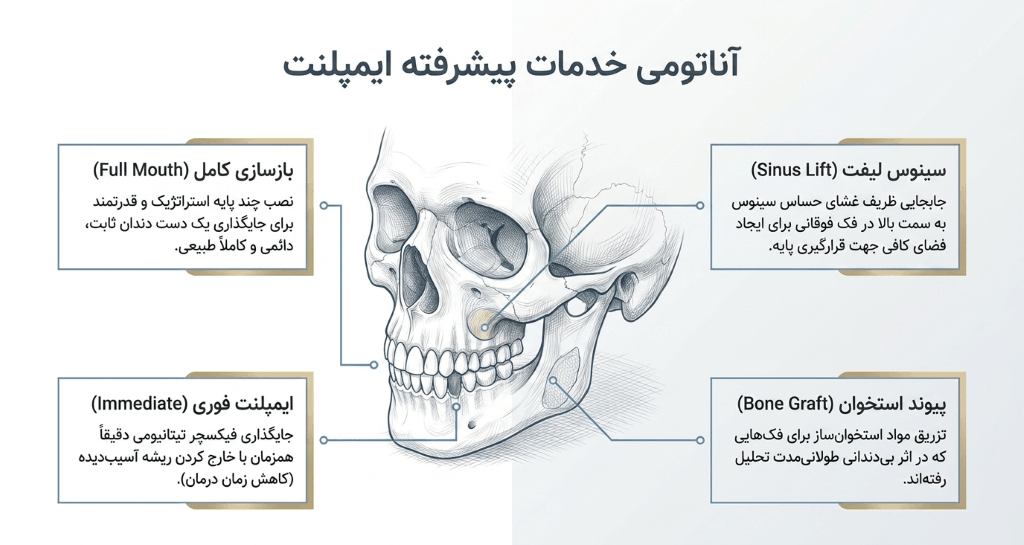 خدمات ایمپلنت در تهرانپارس