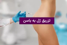 فیلر باسن؛ راهنمای کامل تزریق ژل برای فرم‌دهی و افزایش حجم باسن