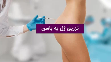 فیلر باسن؛ راهنمای کامل تزریق ژل برای فرمدهی و افزایش حجم باسن