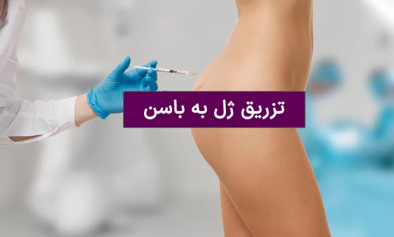 فیلر باسن؛ راهنمای کامل تزریق ژل برای فرمدهی و افزایش حجم باسن